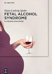 Fetal Alcohol Syndrome: A lifelong Challenge