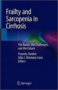 Frailty and Sarcopenia in Cirrhosis: The Basics, the Challenges, and the Future