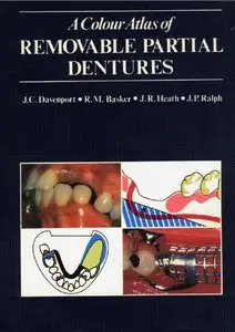 A Colour Atlas of Removable Partial Dentures [Repost]
