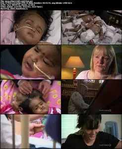 NOVA S39E14 "Separating Twins"