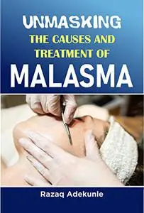 UNMASKING THE CAUSES AND TREATMENTS OF MELASMA