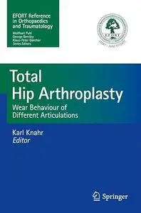 Total Hip Arthroplasty: Wear Behaviour of Different Articulations (Repost)