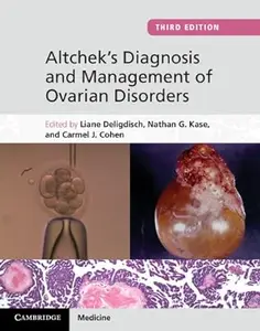 Altchek's Diagnosis and Management of Ovarian Disorders, 3rd Edition