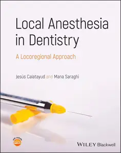 Local Anesthesia in Dentistry: A Locoregional Approach