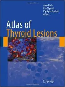 Atlas of Thyroid Lesions by Arne Heilo 