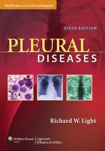 Pleural Diseases, Sixth edition (repost)