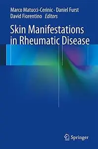 Skin Manifestations in Rheumatic Disease