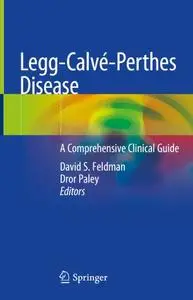 Legg-Calvé-Perthes Disease: A Comprehensive Clinical Guide (Repost)