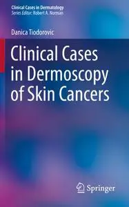 Clinical Cases in Dermoscopy of Skin Cancers (Repost)