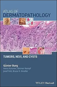 Atlas of Dermatopathology: Tumors, Nevi, and Cysts (Repost)