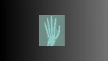 X-Ray Of Wrist And Hand From Zero To Hero