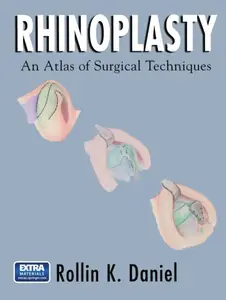 Rhinoplasty: An Atlas of Surgical Techniques