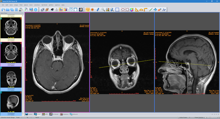 Sante DICOM Viewer 3D Pro 4.9.4