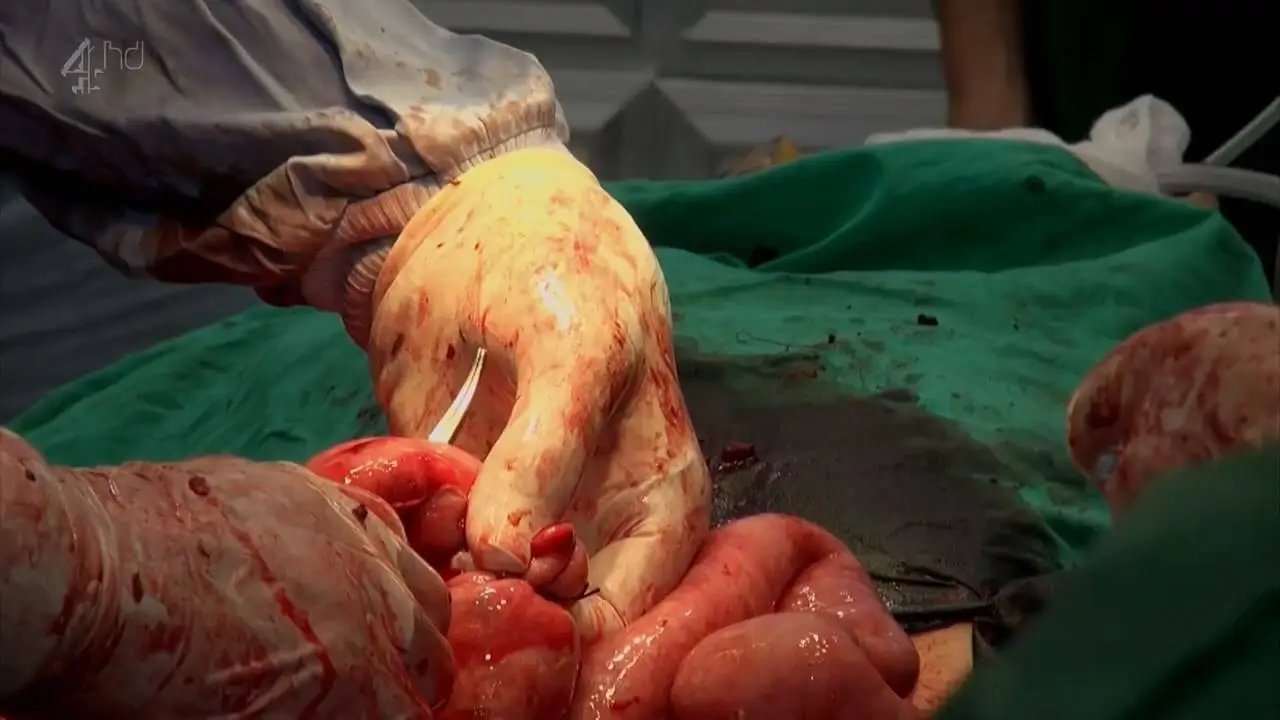 Channel 4 - A and E in the War Zone (2014)