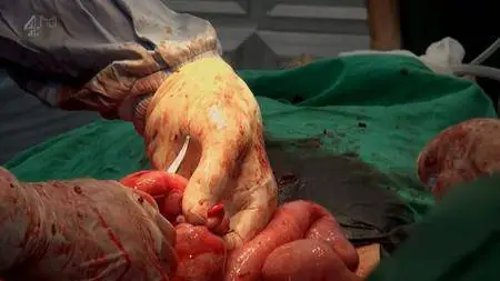 Channel 4 - A and E in the War Zone (2014)