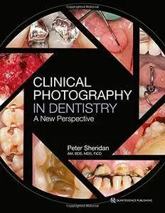 Clinical Photography in Dentistry