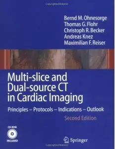 Multi-slice and Dual-source CT in Cardiac Imaging: Principles - Protocols - Indications – Outlook, 2nd edition (repost)