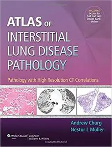 Atlas of Interstitial Lung Disease Pathology (repost)
