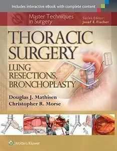 Master Techniques in Surgery: Thoracic Surgery: Lung Resections, Bronchoplasty (repost)