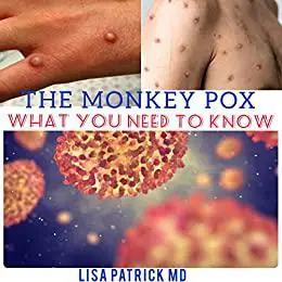 THE MONKEYPOX: WHAT YOU NEED TO KNOW