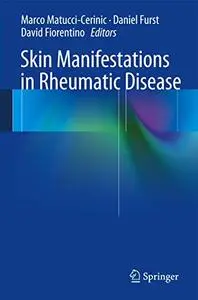 Skin Manifestations in Rheumatic Disease (Repost)