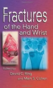 Fractures of the Hand and Wrist