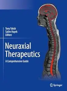 Neuraxial Therapeutics: A Comprehensive Guide