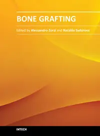 Bone Grafting by Alessandro Zorzi and João Batista de Miranda