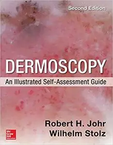 Dermoscopy: An Illustrated Self-Assessment Guide, 2nd Edition