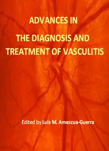 "Advances in the Diagnosis and Treatment of Vasculitis" ed. by Luis M. Amezcua-Guerra