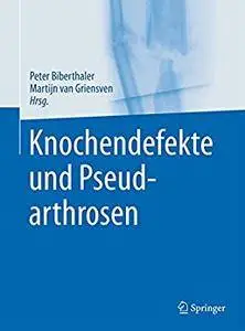 Knochendefekte und Pseudarthrosen [Repost]