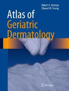 Atlas of Geriatric Dermatology (Repost)