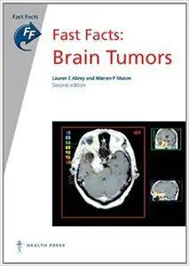 Fast Facts: Brain Tumors, 2nd Edition