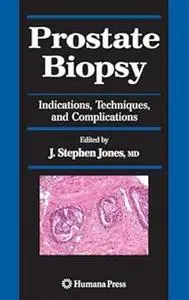 Prostate Biopsy: Indications, Techniques, and Complications (Repost)