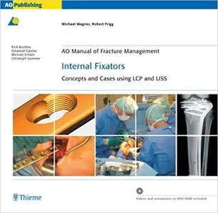 AO Manual of Fracture Management: Internal Fixators: Concepts and Cases using LCP/LISS