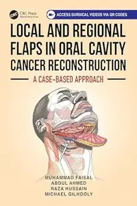 Local and Regional Flaps in Oral Cavity Cancer Reconstruction