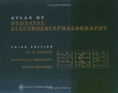 Atlas of Neonatal Electroencephalography (Repost)