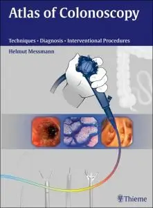 Atlas of Colonoscopy: Techniques, Diagnosis, Interventional Procedures(Repost)