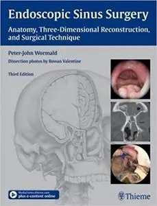 Endoscopic Sinus Surgery: Anatomy, Three-Dimensional Reconstruction, and Surgical Technique Ed 3