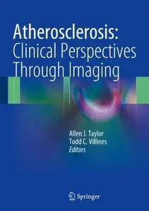 Atherosclerosis: Clinical Perspectives Through Imaging
