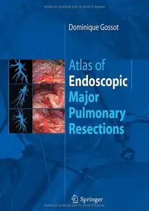 Atlas of Endoscopic Major Pulmonary Resections (Repost)