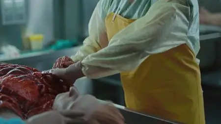 Coroner S02E03