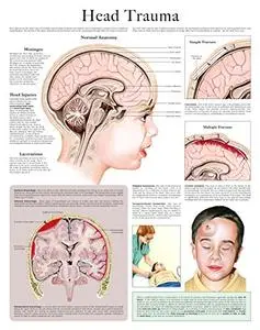 Head trauma e-chart: Quick reference guide