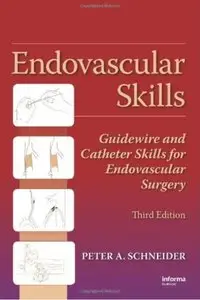 Endovascular Skills: Guidewire and Catheter Skills for Endovascular Surgery (3rd Edition)
