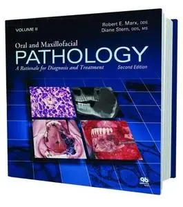 Oral and Maxillofacial Pathology: A Rationale for Diagnosis and Treatment (Repost)