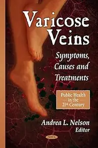 Varicose Veins: Symptoms, Causes and Treatments