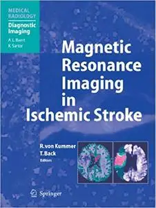 Magnetic Resonance Imaging in Ischemic Stroke (Repost)