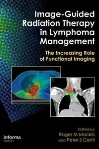 Image-Guided Radiation Therapy in Lymphoma Management: The Increasing Role of Functional Imaging (Repost)