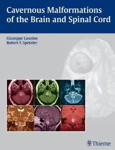 Cavernous Malformations of the Brain and Spinal Cord (Repost)