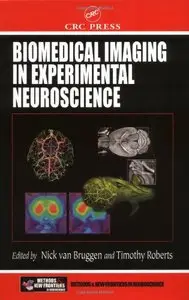 Biomedical Imaging in Experimental Neuroscience (Frontiers in Neuroscience) by Nick Van Bruggen